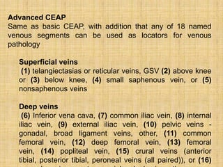 Varicose vein | PPTX