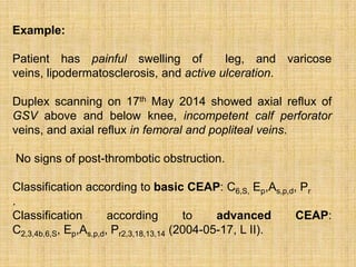 Varicose vein | PPTX