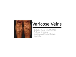 Varicose Veins
Dr. Sudhir Kumar Jain, MS, FRCS
Professor of Surgery,
Maulana Azad Medical College,
New Delhi
 