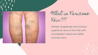 What is Varicose
Vein???
Dilated, lengthened and tortuous
superficial veins of the limb with
incompetent valves are called
varicose veins.
 