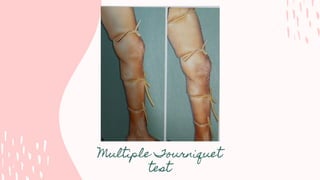 Multiple Tourniquet
test
 