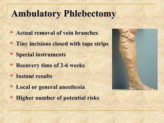 Ambulatory PhlebectomyAmbulatory Phlebectomy
 Actual removal of vein branches
 Tiny incisions closed with tape strips
 ...
