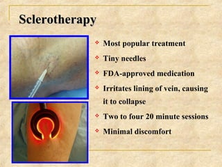 SclerotherapySclerotherapy
 Most popular treatment
 Tiny needles
 FDA-approved medication
 Irritates lining of vein, c...