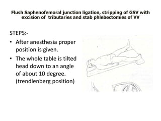 Varicose vein ANATOMY,PATHOPHYSIOLOGY & MANAGEMANT | PPTX