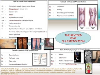 varicose vein ppt swollen, and twisted veins that commonly appear on ...