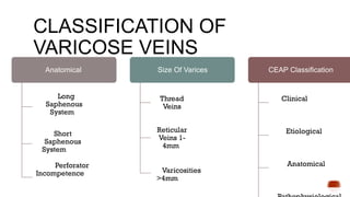 Comprehensive Overview of Varicose Veins: Anatomy, Pathogenesis ...