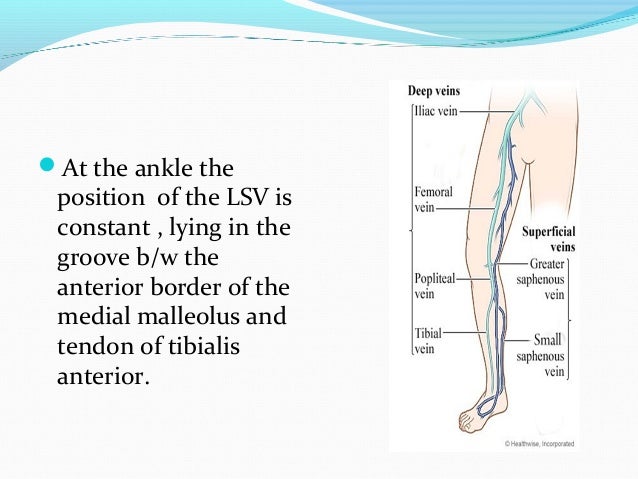 Varicose vein ppt (thu)