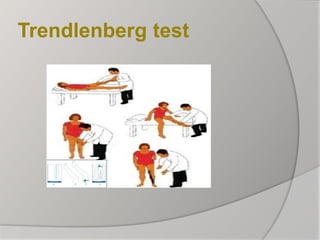 Trendlenberg test
 