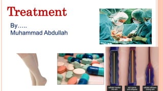 Treatment
By…..
Muhammad Abdullah
 