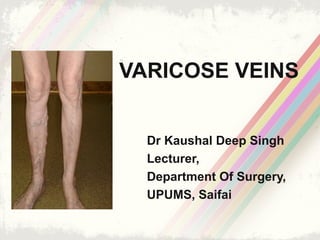 VARICOSE VEINS
Dr Kaushal Deep Singh
Lecturer,
Department Of Surgery,
UPUMS, Saifai
 