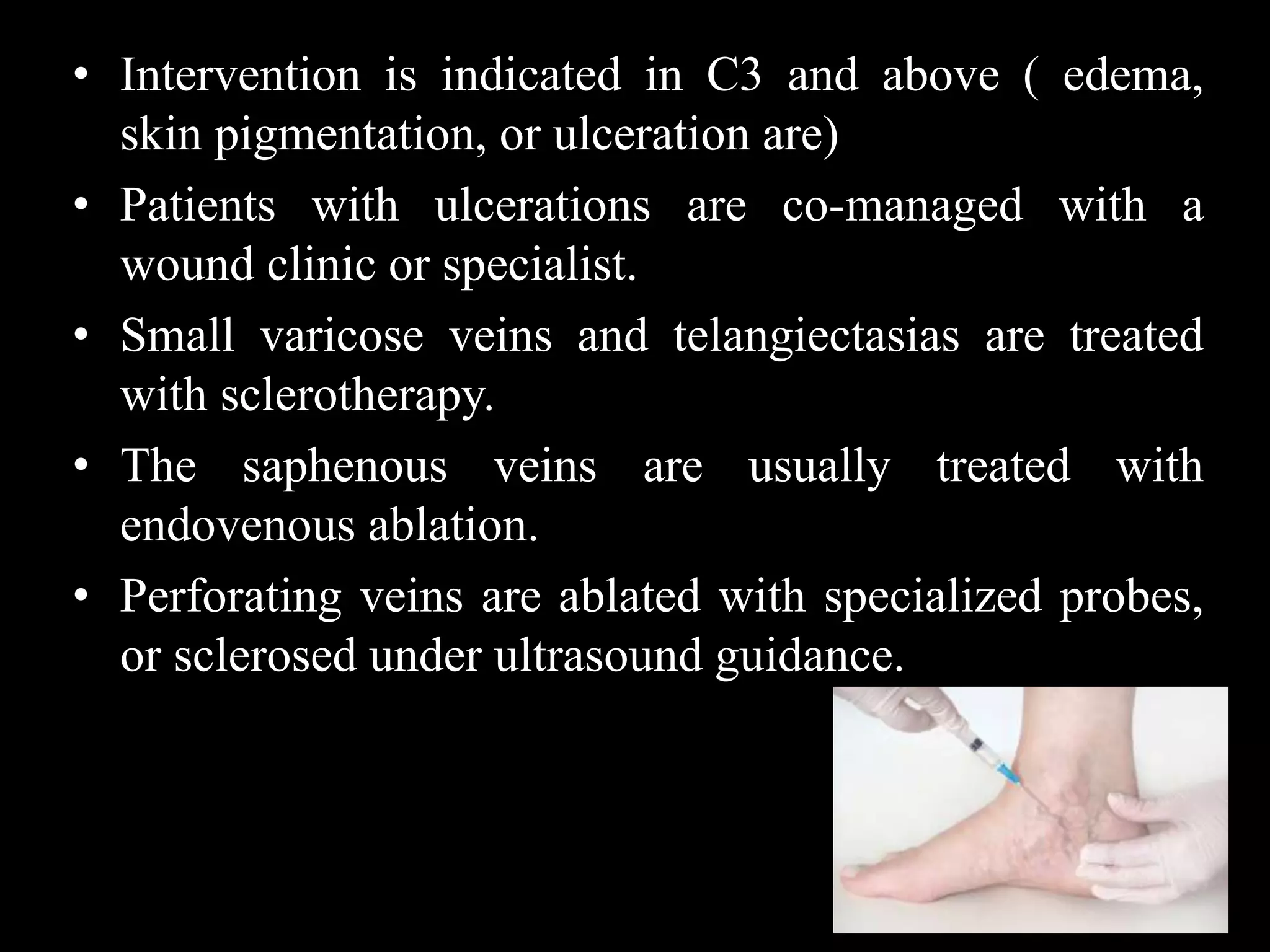 Diagnosis and radiological management of varicose vein | PPTX