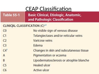 Varicose Veins anatomy and pathology and management | PPTX