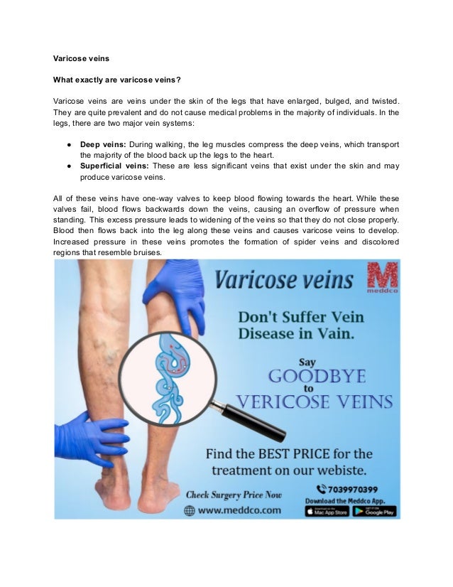 Varicose veins
What exactly are varicose veins?
Varicose veins are veins under the skin of the legs that have enlarged, bulged, and twisted.
They are quite prevalent and do not cause medical problems in the majority of individuals. In the
legs, there are two major vein systems:
● Deep veins: During walking, the leg muscles compress the deep veins, which transport
the majority of the blood back up the legs to the heart.
● Superficial veins: These are less significant veins that exist under the skin and may
produce varicose veins.
All of these veins have one-way valves to keep blood flowing towards the heart. While these
valves fail, blood flows backwards down the veins, causing an overflow of pressure when
standing. This excess pressure leads to widening of the veins so that they do not close properly.
Blood then flows back into the leg along these veins and causes varicose veins to develop.
Increased pressure in these veins promotes the formation of spider veins and discolored
regions that resemble bruises.
 