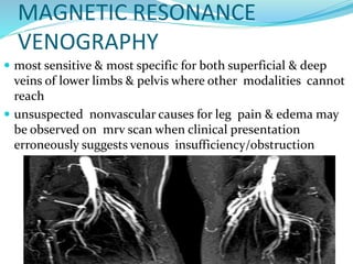 MAGNETIC RESONANCE
VENOGRAPHY
 most sensitive & most specific for both superficial & deep
veins of lower limbs & pelvis where other modalities cannot
reach
 unsuspected nonvascular causes for leg pain & edema may
be observed on mrv scan when clinical presentation
erroneously suggests venous insufficiency/obstruction
 