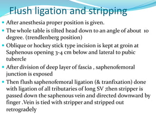 Flush ligation and stripping
 After anesthesia proper position is given.
 The whole table is tilted head down to an angle of about 10
degree. (trendlenberg position)
 Oblique or hockey stick type incision is kept at groin at
Saphenous opening 3-4 cm below and lateral to pubic
tubercle
 After division of deep layer of fascia , saphenofemoral
junction is exposed
 Then flush saphenofemoral ligation (& tranfixation) done
with ligation of all tributaries of long SV ;then stripper is
passed down the saphenous vein and directed downward by
finger .Vein is tied with stripper and stripped out
retrogradely
 
