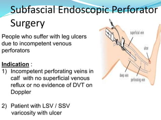 Subfascial Endoscopic Perforator
Surgery
People who suffer with leg ulcers
due to incompetent venous
perforators
Indication :
1) Incompetent perforating veins in
calf with no superficial venous
reflux or no evidence of DVT on
Doppler
2) Patient with LSV / SSV
varicosity with ulcer
 