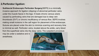 2.Perforator ligation:
• Subfascial Endoscopic Perforator Surgery(SEPS) is a minimally
invasive approach for ligation (clipping) of abnormal perforator veins
under the muscle fascia in the legs. It treats chronic venous ulcers
caused by perforating veins that are damaged due to deep vein
thrombosis (DVT) or chronic insufficiency of venous flow. SEPS involves
making small incisions in the calf region for placement of the endoscope.
Sutures are placed under the skin to minimize scarring and recovery time
is minimal as well. Perforator veins, located above the ankle, carry blood
from the superficial veins into the deep veins. The outpatient procedure
may be under a sedative and regional anesthesia or under general
anesthesia.
4/4/2019Shubham Gupta ©
 
