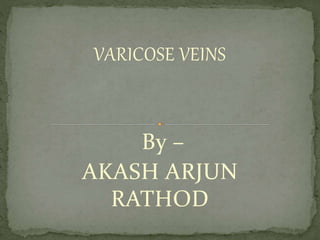 VARICOSE VEINS
By –
AKASH ARJUN
RATHOD
 
