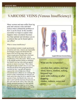 VARICOSE VEINS (Venous Insufficiency)
AUGUST 2014
Many women and men suffer from leg
pain and varicose veins and don't
realize what is behind the problem or
how it can be fixed. In this month's
newsletter we hope to explain what
happens when circulation becomes
less than optimal and introduce you to
a solution that can be found right in
our office!
What is venous insufficiency?
Our circulatory system is made up primarily
of arteries and veins. Arteries are responsible
for bringing oxygen-rich blood from the
heart to the rest of the body while veins
return oxygen-poor blood back to the heart.
When veins fail to do their job, venous
insufficiency (VI) is the result. When we are
in the upright position (sitting or standing),
the blood in our leg veins must go against
gravity to return to our heart. This is done
through the help of small valves in our veins
that prevent blood from going back down
towards the feet. Leg and calf muscles
squeeze the veins to help move blood
towards the heart. When we are walking, this
process works well because our muscles are
more active but when we sit or stand for long
periods of time, the blood in the veins can
start to pool and this increases the pressure in
the veins and on the valves. Our veins can
handle increased pressure for short periods
but if we continue to stand or sit for longer
periods of time, the vein walls as well as the
valves can start to stretch and weaken.
What are the symptoms?
-swollen feet, ankles, and legs
-tired, heavy, restless, aching,
fatigued legs
-pain with walking or after
stopping
-rashes, redness, sores and
ulcers
 