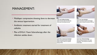 varicose veins a case presentation dr ayesha.pptx