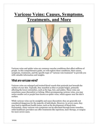 VIVAA
Varicose Veins: Causes, Symptoms,
Treatments, and More
Varicose veins and spider veins are common vascular conditions that affect millions of
people. In this comprehensive guide, we will explore these conditions, their causes,
symptoms, treatments, and the specific topic of "varicose vein treatment" to provide you
with valuable information and insights.
Whatarevaricoseveins?
Varicose veins are enlarged and twisted blood vessels that protrude just beneath the
surface of your skin. Typically, they manifest as blue or purple bulges, primarily
affecting the lower extremities, such as the legs, feet, and ankles. These veins can
sometimes cause discomfort or itching. Often accompanying varicose veins, you may
notice smaller red or purple lines known as spider veins, which appear near the skin's
surface.
While varicose veins can be unsightly and cause discomfort, they are generally not
considered dangerous for the majority of individuals. However, in severe cases, they
may lead to significant health issues, such as the development of blood clots.
Fortunately, many varicose vein symptoms can be alleviated through home remedies,
while healthcare providers can offer treatments like injections, laser therapy, or surgery
for more severe cases.
 