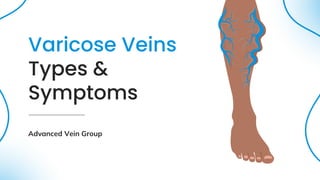 Varicose Veins
Types &
Symptoms
Advanced Vein Group
 