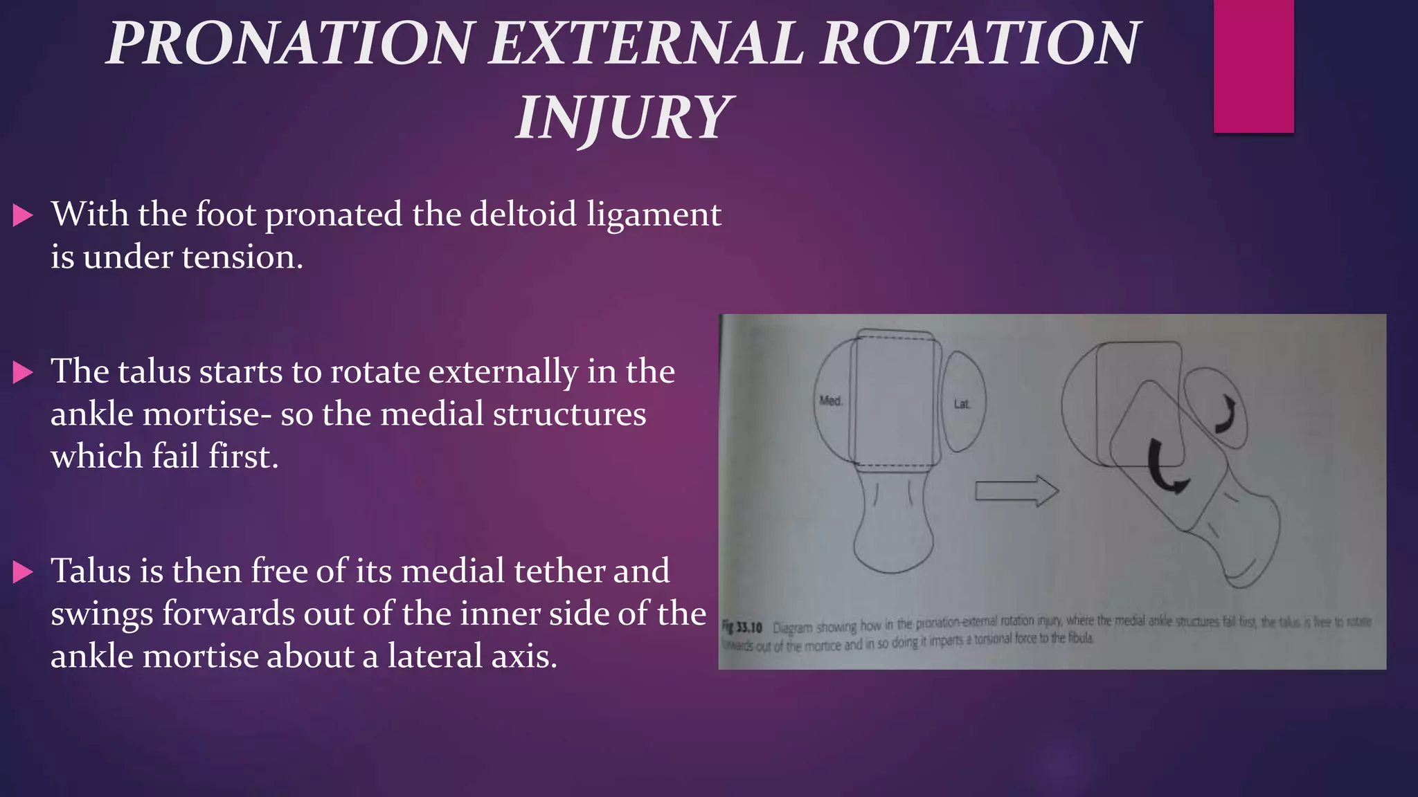 Ankle Rptation Injury Various ankle injuries and it’s management | PPTX