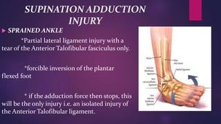 SUPINATION ADDUCTION
INJURY
 SPRAINED ANKLE
*Partial lateral ligament injury with a
tear of the Anterior Talofibular fasciculus only.
*forcible inversion of the plantar
flexed foot
* if the adduction force then stops, this
will be the only injury i.e. an isolated injury of
the Anterior Talofibular ligament.
 