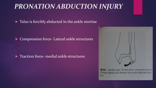 PRONATION ABDUCTION INJURY
 Talus is forcibly abducted in the ankle mortise
 Compression force- Lateral ankle structures
 Traction force- medial ankle structures
 