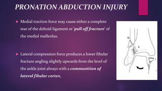 PRONATION ABDUCTION INJURY
 Medial traction force may cause either a complete
tear of the deltoid ligament or ‘pull off fracture’ of
the medial malleolus.
 Lateral compression force produces a lower fibular
fracture angling slightly upwards from the level of
the ankle joint always with a communition of
lateral fibular cortex.
 