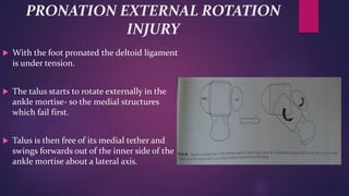 PRONATION EXTERNAL ROTATION
INJURY
 With the foot pronated the deltoid ligament
is under tension.
 The talus starts to rotate externally in the
ankle mortise- so the medial structures
which fail first.
 Talus is then free of its medial tether and
swings forwards out of the inner side of the
ankle mortise about a lateral axis.
 