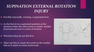 SUPINATION EXTERNAL ROTATION
INJURY
 Forcibly externally rotating a supinated foot.
 As the foot is in a supinated position at the
moment when the talus starts to rotate- medial
structures are not in a state of tension.
 Therefore they do not fail first.
 Talus not free to rotate forwards on the medial
side so it starts to rotate backwards.
 