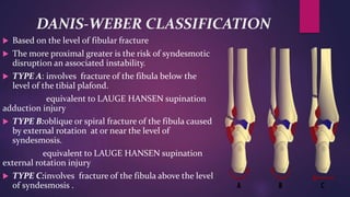 DANIS-WEBER CLASSIFICATION
 Based on the level of fibular fracture
 The more proximal greater is the risk of syndesmotic
disruption an associated instability.
 TYPE A: involves fracture of the fibula below the
level of the tibial plafond.
equivalent to LAUGE HANSEN supination
adduction injury
 TYPE B:oblique or spiral fracture of the fibula caused
by external rotation at or near the level of
syndesmosis.
equivalent to LAUGE HANSEN supination
external rotation injury
 TYPE C:involves fracture of the fibula above the level
of syndesmosis .
 