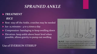 SPRAINED ANKLE
 TREATMENT
RICE
 Rest- stay off the Ankle, crutches may be needed
 Ice- 15 minutes - 4 to 5 times a day
 Compression- bandaging to keep swelling down
 Elevation- keep ankle above heart level when
possible, allows gravity to pump out swelling
Use of EVERSION STIRRUP
 
