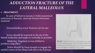 ADDUCTION FRACTURE OF THE
LATERAL MALLEOLUS
 TREATMENT:
In case of failure to secure or hold anatomical
reduction of fracture, internal fixation becomes
essential
Intramedullary screw fixation can be one.
Screw should be inserted at the tip of the
lateral malleolus and angle as vertically as possible.
Malleolar fragment is over drilled to
produce a lag effect.
Screw should be long enough to engage the
medial cortex of the fibula well above the fracture
 