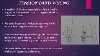 TENSION BAND WIRING
 A method of fixation, especially useful for smaller
fragments is the tension band wiring described by
Weber and Vasey
 Reduced fragments are fixed using two parallel K-
wires at right angle to the fracture plane.
 A horizontal through and through drill hole is then
made about 3cms proximal to the fracture and a
length of 20 G SS wire is passed through the hole.
 The ends of the wire are crossed over and the two ends
of the loop tightened and twisted.
 