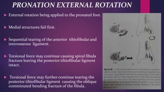 PRONATION EXTERNAL ROTATION
 External rotation being applied to the pronated foot.
 Medial structures fail first.
 Sequential tearing of the anterior tibiofibular and
interosseous ligament.
 Torsional force may continue causing spiral fibula
fracture leaving the posterior tibiofibular ligment
intact.
 Torsional force may further continue tearing the
posterior tibiofibular ligment causing the oblique
comminuted bending fracture of the fibula.
 