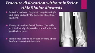 Fracture dislocation without inferior
tibiofibular diastasis
 Posterior malleolar fragment comprise a single
unit being united by the posterior tibiofibular
ligament.
 History of considerable violence to the ankle
an it is clinically obvious that the ankle joint is
greatly deformed.
 Prominence of the heel with shortening of the
forefoot –posterior dislocation.
 