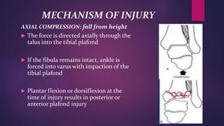 MECHANISM OF INJURY
AXIAL COMPRESSION: fall from height
 The force is directed axially through the
talus into the tibial plafond
 If the fibula remains intact, ankle is
forced into varus with impaction of the
tibial plafond
 Plantar flexion or dorsiflexion at the
time of injury results in posterior or
anterior plafond injury
 