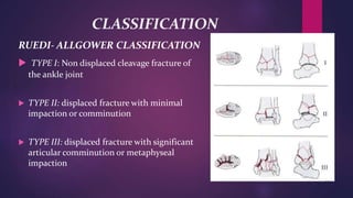 CLASSIFICATION
RUEDI- ALLGOWER CLASSIFICATION
 TYPE I: Non displaced cleavage fracture of
the ankle joint
 TYPE II: displaced fracture with minimal
impaction or comminution
 TYPE III: displaced fracture with significant
articular comminution or metaphyseal
impaction
 