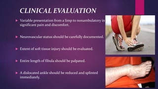 CLINICAL EVALUATION
 Variable presentation from a limp to nonambulatory in
significant pain and discomfort.
 Neurovascular status should be carefully documented.
 Extent of soft tissue injury should be evaluated.
 Entire length of fibula should be palpated.
 A dislocated ankle should be reduced and splinted
immediately.
 