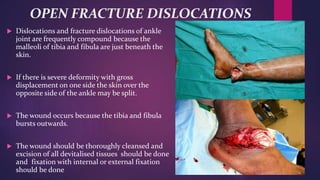 OPEN FRACTURE DISLOCATIONS
 Dislocations and fracture dislocations of ankle
joint are frequently compound because the
malleoli of tibia and fibula are just beneath the
skin.
 If there is severe deformity with gross
displacement on one side the skin over the
opposite side of the ankle may be split.
 The wound occurs because the tibia and fibula
bursts outwards.
 The wound should be thoroughly cleansed and
excision of all devitalised tissues should be done
and fixation with internal or external fixation
should be done
 