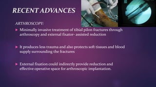 RECENT ADVANCES
ARTHROSCOPY:
 Minimally invasive treatment of tibial pilon fractures through
arthroscopy and external fixator- assisted reduction
 It produces less trauma and also protects soft tissues and blood
supply surrounding the fractures
 External fixation could indirectly provide reduction and
effective operative space for arthroscopic implantation.
 