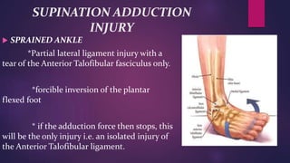 Ankle supination trauma