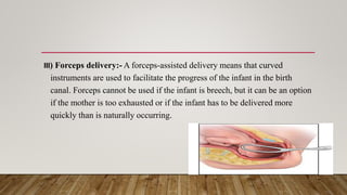 Using Forceps During Delivery Various child birth practices | PPTX