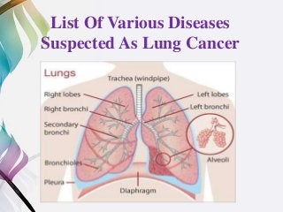 List Of Various Diseases
Suspected As Lung Cancer
 
