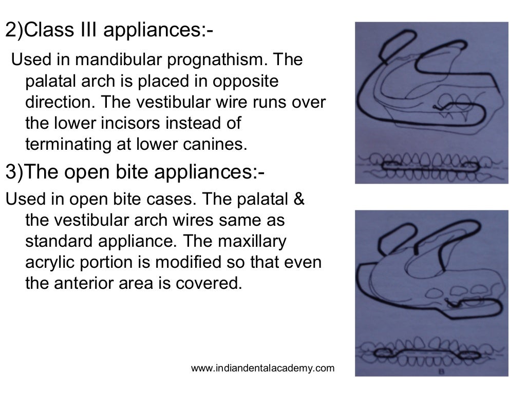 Various functional appliances & its components /certified fixed ortho…
