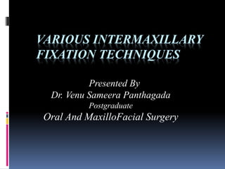 VARIOUS INTERMAXILLARY
FIXATION TECHNIQUES
Presented By
Dr. Venu Sameera Panthagada
Postgraduate
Oral And MaxilloFacial Surgery
 