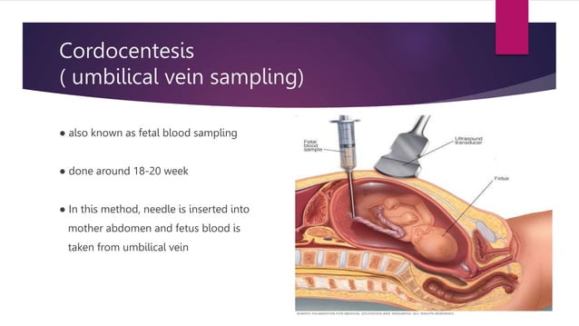 Various Methods Of Prenatal Diagnosis pptx various-methods-of-prenatal-diagnosis-pptx