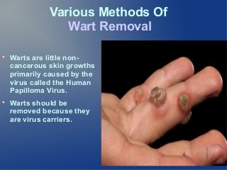 Various Methods Of
Wart Removal




Warts are little noncancerous skin growths
primarily caused by the
virus called the Human
Papilloma Virus.
Warts should be
removed because they
are virus carriers.

 